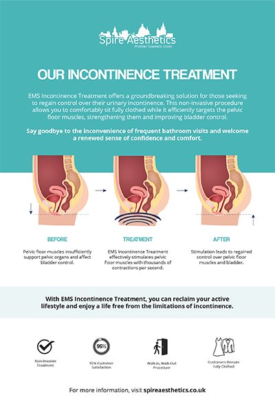 image to show how EMS treatment works for female urinary incontinence Stirling