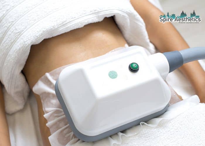 Shift Those Extra Pounds: How Fat Freezing Can Help You Slim Down Stirling