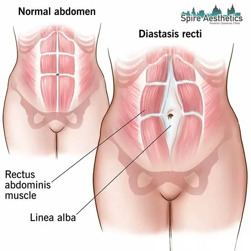When Will My Belly Feel Normal Again Stirling?