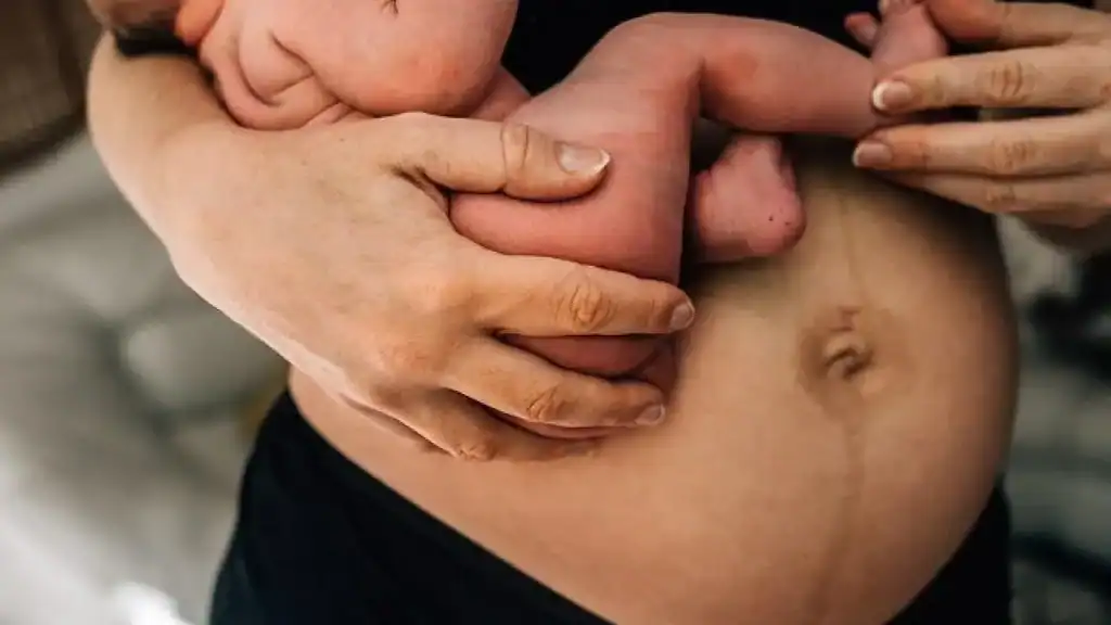 Why Is My Stomach Still Big After Pregnancy Stirling?